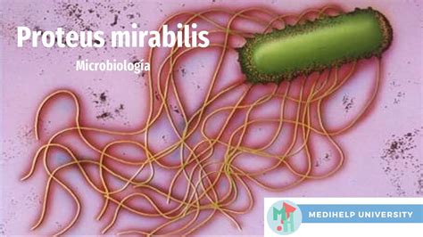 proteus mirabilis behandling.